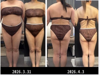 モミン(MOMI.N)の写真