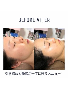 ルサンク(le cinq)/一度試してみてください！