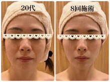 エピファニー(Epi phany Total Beauty Salon)/【小顔エステ】