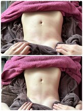 シャルム(Charme)/韓国初当サロンだけのだけの痩身