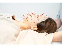 ミロクの里鍼灸院 東長崎店/【美容鍼】【東長崎】