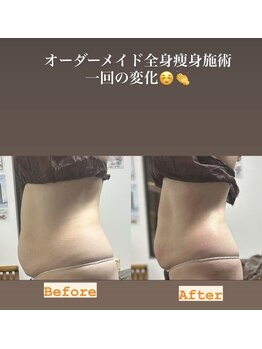 アローナ(ARONA)/一度でしっかり本気の結果だし！