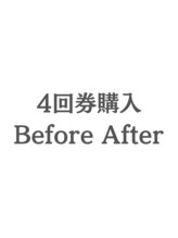 ホワイトニングカフェ 茨木店/