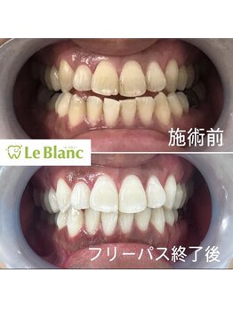 ルブラン 奈良店(Le Blanc)/フリーパスは最低保証付き♪