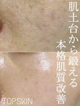 トップスキン 表参道(TOPSKIN)&nbsp;肌質改善＆ 肌管理