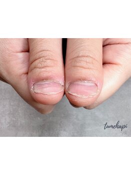 爪の悩みを解消できる（ケア含む）