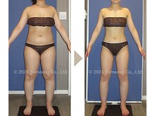 【17か月間の結果】体重▲14.55kg 体脂肪▲14.3%　ウエスト▲15.3cm　ヒップ▲16cm 太もも▲9.5cm