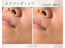 スリースリー(THREE THREE)/エイジング・しわケア