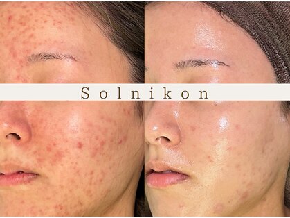 ソルニコン(Solnikon)の写真