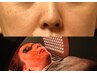 《毛穴の開き・たるみ毛穴徹底改善》毛穴リペア炭酸パック美容鍼＋LED