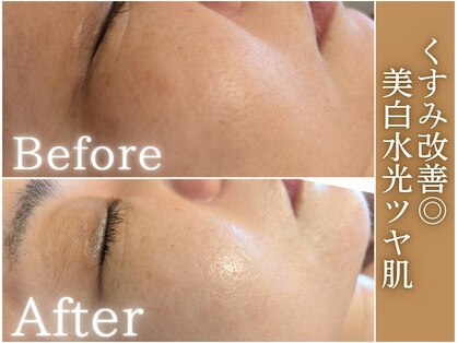 サロンドエステ ルヴニール(salon de esthe revenir)の写真