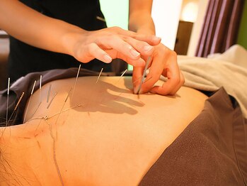 ビアンカ 目黒本院(Bianca)の写真/どこに行っても解決できなかった方の駆け込みサロン◎一人ひとりに合わせたオーダーメイド施術で根本改善