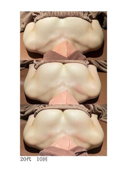 ロココ 錦糸町店(Rococo)/比較写真