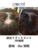 ザ ベッピン(the 別嬪)/頭皮は提携美容院にて施術可能