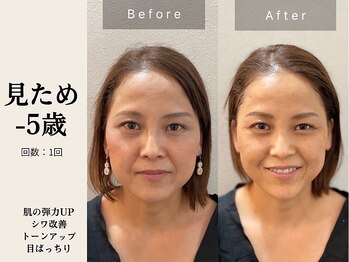 サロン ルイス アディクト(salon Lewis Addict)/ハイアールエフウェーブ