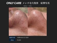 オンリィケア 関大前(ONLY CARE)/【メンズ毛穴洗浄】