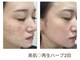 ブルームエイト(Bloom8)の写真/《驚きの変化に感動の声多数》結果重視×ベテランスタッフの施術で大満足◎高評価口コミもご確認下さい！
