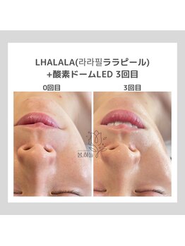 ポムハヌル(pom.haneul)/韓国肌管理室