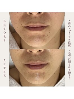 クラームビューティー(Clerm beauty)/リアボーテタラソトリートメント