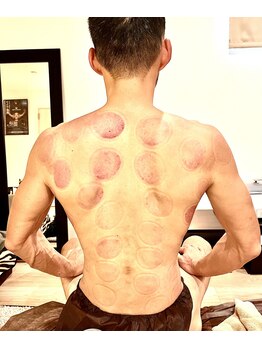 ラクア/カッピング&ボディケアコース