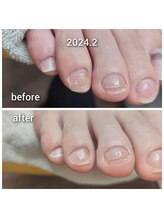 爪切り屋 足楽/ＵＶジェルソフト