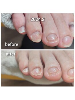 ＵＶジェルソフト