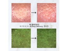 ベベ 目黒店(Be'be')の雰囲気（施術前後に毛穴専用カメラでしっかりと効果を実感できます！）