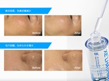 ラヴィニティ 池袋(Lavinity)の雰囲気（『肌を育てる』ララorセラピールで韓国アイドルのような水光肌に）