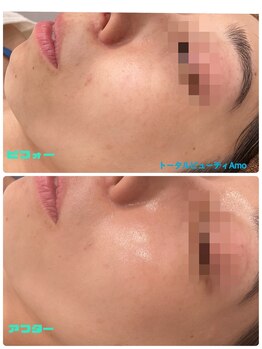 アモ(amo)/クリスティーナアンストレス