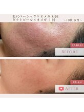 エクラ アン(eclat.un)/10代女性