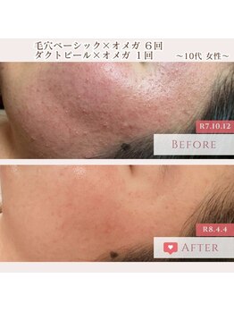 エクラ アン(eclat.un)/10代女性