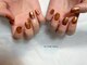 イン ザ ネイル(in the nail)の写真
