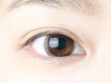 ビー バイ アイキャンディー(B by eye candy)/施術前 [正面] before