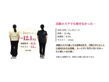ゆうきや整体院/高級エステでもやせれなかった…