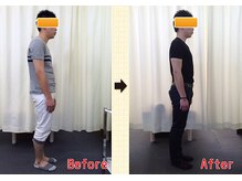 なぎ整体院/猫背矯正ビフォーアフター