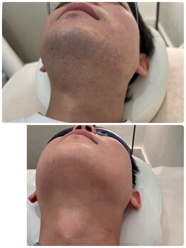 グランツ(GLANZ)/