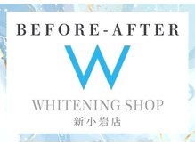 ホワイトニングショップ 新小岩店/症例数No. 1☆ホワイトニング