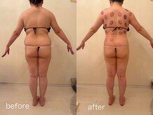 クロレ 浦和店(CLORE)/30代のお客様/7回施術