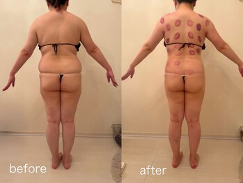 クロレ 浦和店(CLORE)/30代のお客様/7回施術