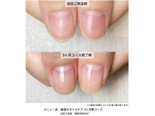 ネイルサロン ラピエトラ(la pietra)