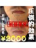 【初回限定★ヒゲ脱毛半額】清潔感アップ体験♪¥2000/都度払い
