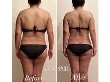 アプローズ(APPLAUSE)/落ちにくいセル脂肪分解　