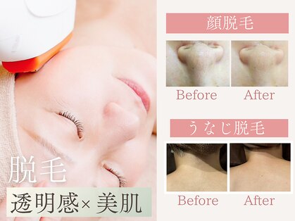 トータルビューティー ゆみえエステ(Total Beauty)の写真