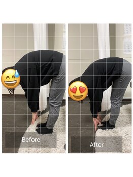 ナオル整体 浅草院(NAORU整体)/20代女性 腰痛・猫背【前屈】