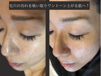 ビビ(VIVI)/毛穴洗浄×マツエク120本