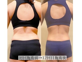 アンジー(Angie)/後ろ姿が綺麗に