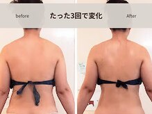 イクヨノ ビューティーサロン(194's beauty salon)/肩甲骨美調整ブライダルボディ