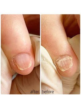 リネイル 長浜(Re-na-iL)/ネイルケア＆スパ¥7000