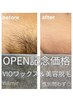 札幌最安値!!【*OPEN記念価格*】VIOブラジリアンワックス+美容脱毛 ¥5980