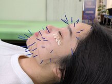 アスミルはり灸接骨院